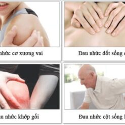Cao dán giảm đau xương khớp salonpas hisamitsu