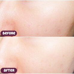 Nước Hoa Hồng Lá Tía Tô Chinoshio Perilla Natural Skin Lotion Nước Hoa Hồng Lá Tía Tô Chinoshio Perilla Natural Skin Lotion