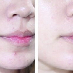 Nước Hoa Hồng Lá Tía Tô Chinoshio Perilla Natural Skin Lotion Nước Hoa Hồng Lá Tía Tô Chinoshio Perilla Natural Skin Lotion