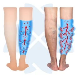 Viên Uống Hỗ Trợ Bền Thành Mạch Giảm Suy Giãn Tĩnh Mạch Chân Felix Hộp 60 viên