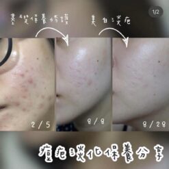 Nước Hoa Hồng Kiểm Soát Dầu Hỗ Trợ Giảm Mụn Meishoku Bigansui Skin Lotion Nước Hoa Hồng Kiểm Soát Dầu Hỗ Trợ Giảm Mụn Meishoku Bigansui Skin Lotion