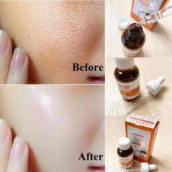 Serum Se Khít Lỗ Chân Lông Labo Labo VC Super Keana 40ml