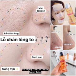 Lotion Se Khít Lỗ Chân Lông Labo Labo Super Keana Lotion Se Khít Lỗ Chân Lông Labo Labo Super Keana