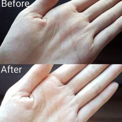 Kem Dưỡng Ẩm Yuskin Trị Nứt Nẻ Tay Và Vết Rạn Da 120g Kem Dưỡng Ẩm Yuskin Trị Nứt Nẻ Tay Và Vết Rạn Da 120g