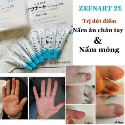 Thuốc Trị Nấm Da Của Nhật ZEFNART 2%