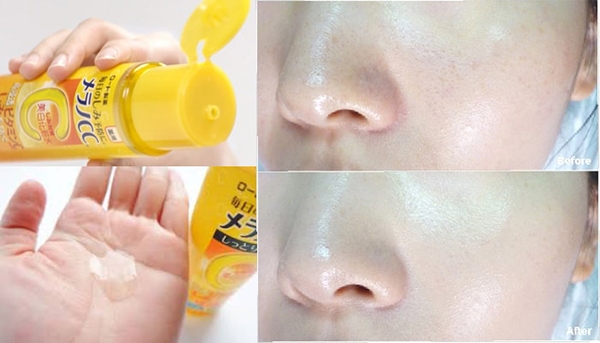 Nước Hoa Hồng Rohto Melano CC Dưỡng Trắng Mờ Thâm Nước Hoa Hồng Rohto Melano CC Dưỡng Trắng Mờ Thâm